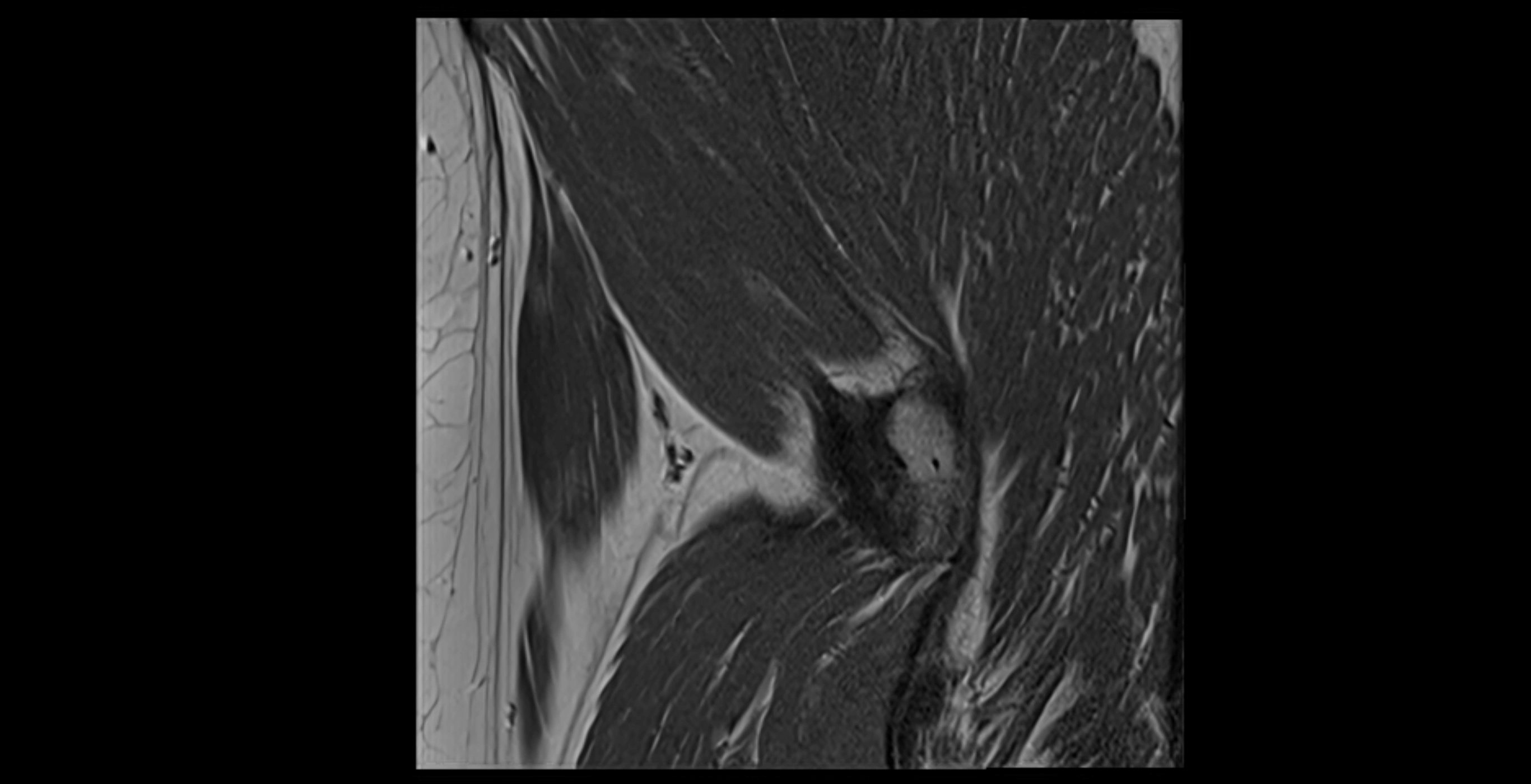 MRI Hip ligaments sagittal cross sectional anatomy 3T  radiology  image-img-00001-00025.webp